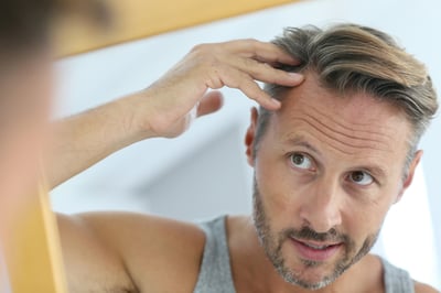 Middle-aged man concerned by hair loss