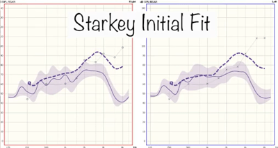 Starkey Initial Fit